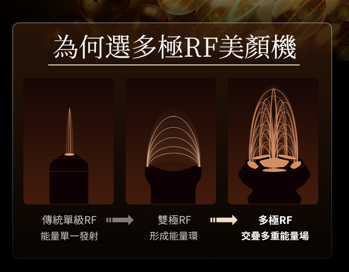 ANLAN - 18K 晶鑽射頻美容儀Pro(黑金色)|射頻儀|EMS微電流|面部按摩器|多功能美容儀|導出儀|LED光療機|射頻機|導入儀|家用美容儀 ADRY31-01A