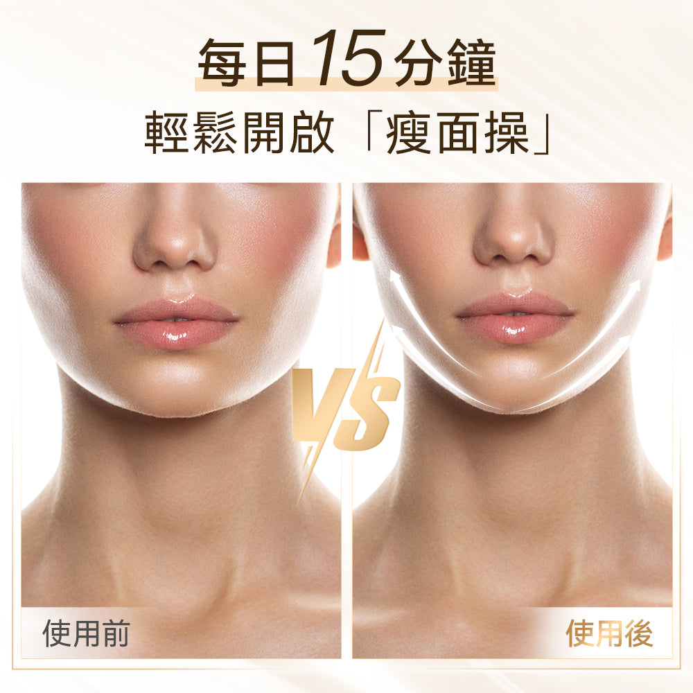 ANLAN - Shining V Face Device 閃耀四極V臉儀 01-AVLY41-02A|面部按摩器|美容機|臉部按摩器|瘦面機|瘦臉機|小顏美顏器
