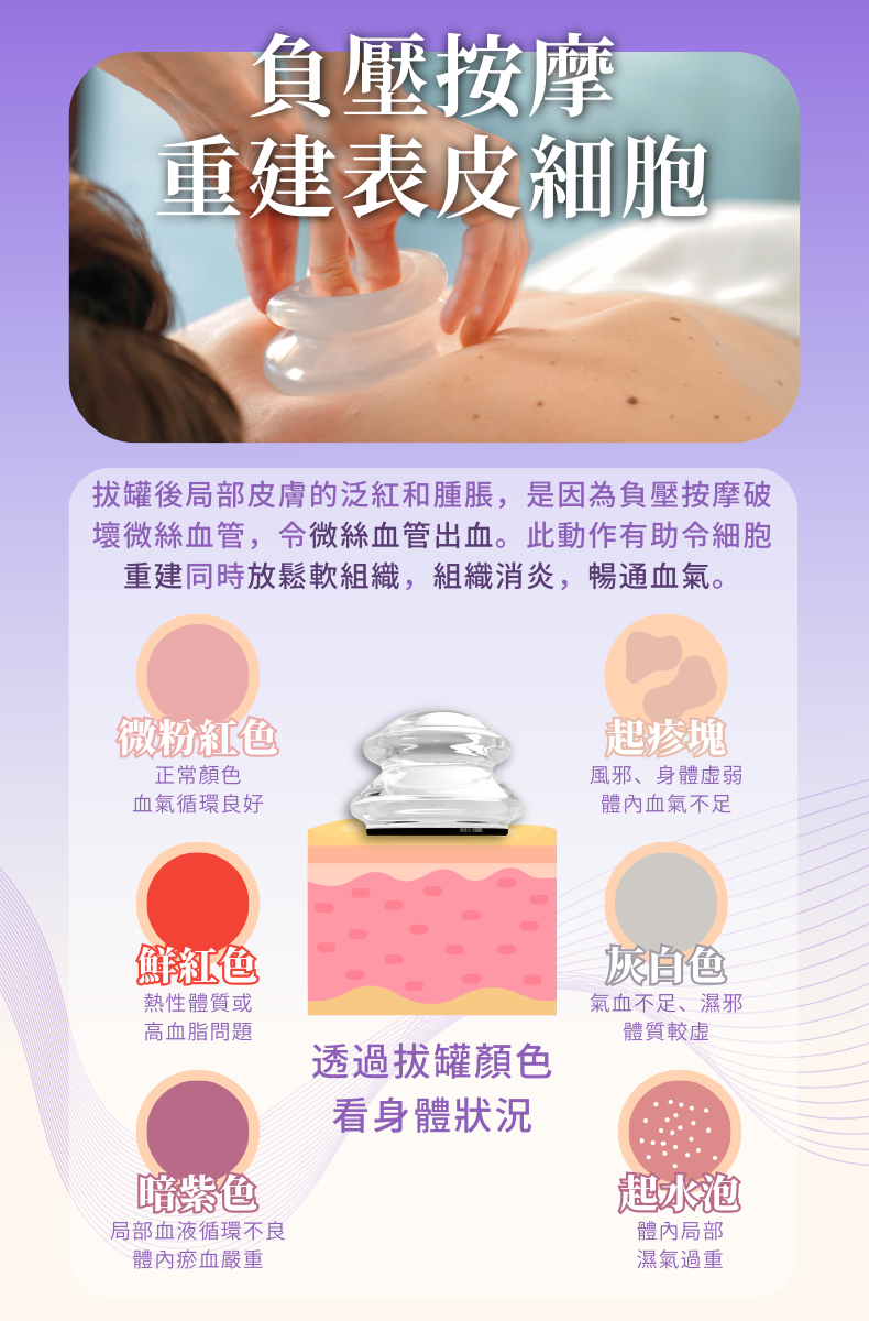 綠島-專利低頻脈衝電磁拔罐器EC800 | 100%食品級矽膠材質|中醫健康 | 電拔罐 | FDA 認證