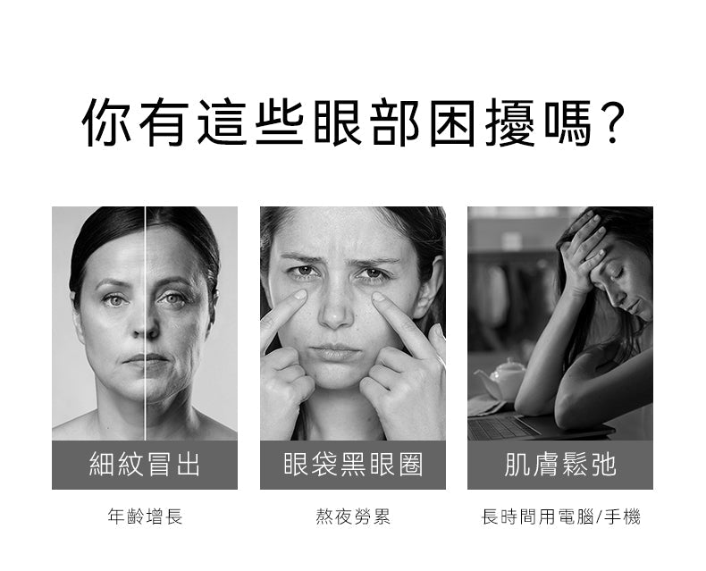 ANLAN - EMS 小白裙美眼儀｜眼部按摩儀｜面部按摩器｜光療機｜EMS微電流 AMYY31-02A ANLAN