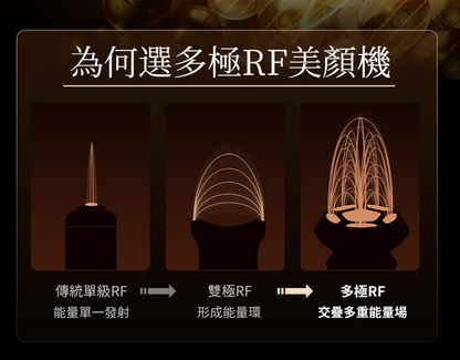 ANLAN - 18K 晶鑽射頻美容儀Pro（黑金色)｜射頻儀｜EMS微電流｜面部按摩器｜多功能美容儀｜導出儀｜LED光療機｜射頻機｜導入儀｜家用美容儀 ADRY31-01A