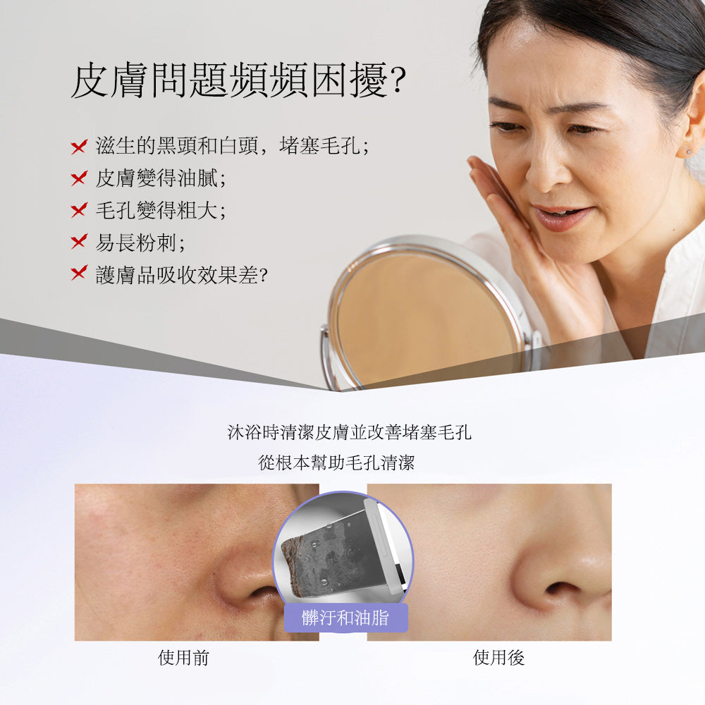 ANLAN - (白色) 六合一 紅藍光超聲鏟皮機 ACPJ31-02A ANLAN