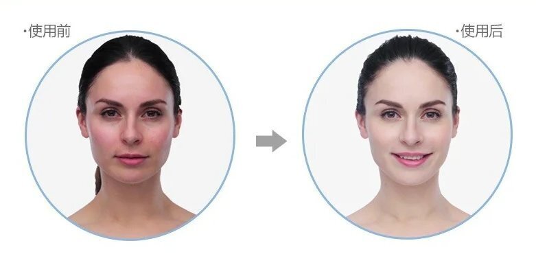 Oreadex - 【香港行貨】離子保濕RF射頻美顏儀 OD1390 Oreadex