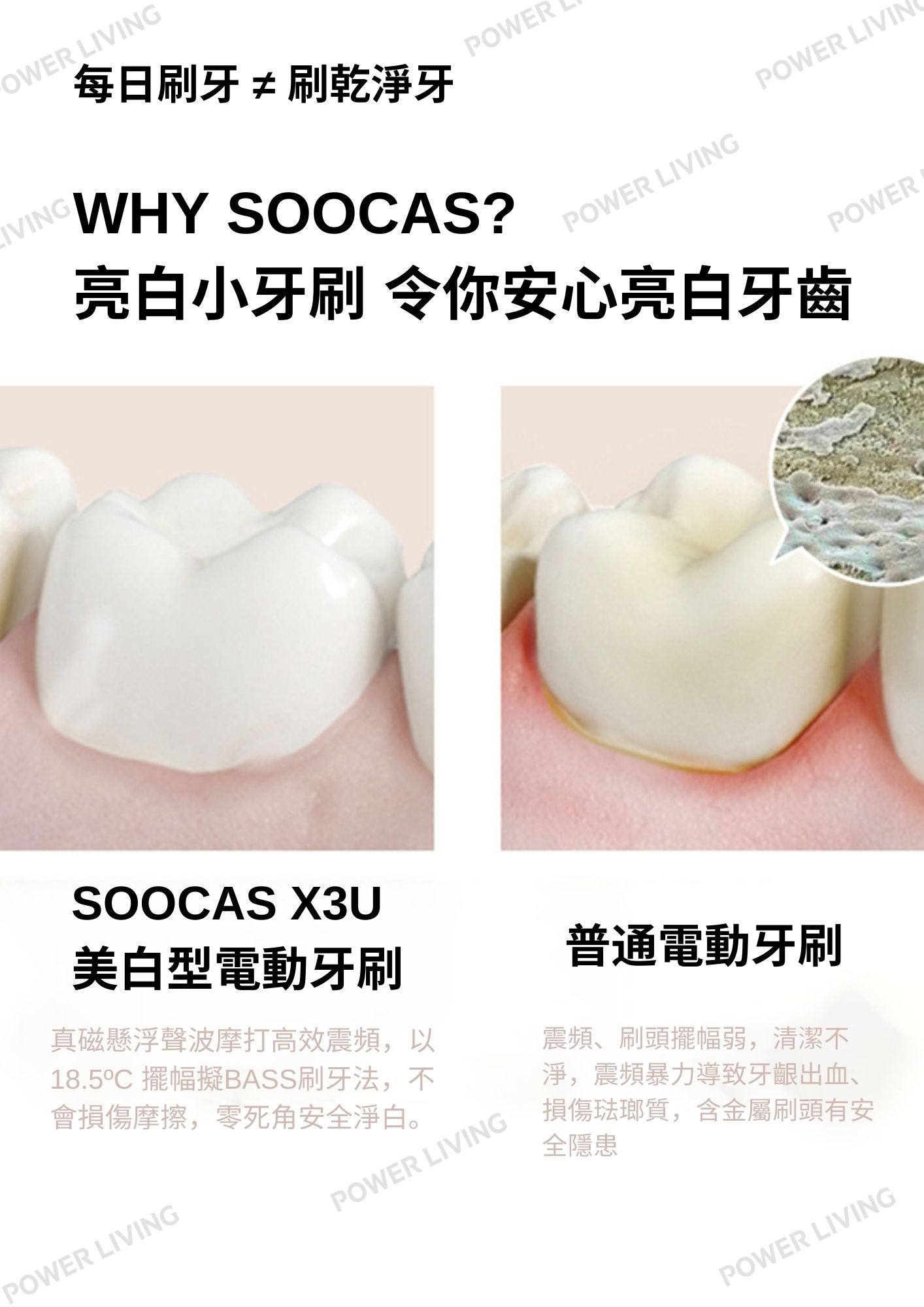 SOOCAS - X3U美白型聲波電動牙刷 (黑色）【香港行貨】 SOOCAS